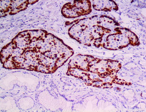 IHC of Glucagon BSB-111 on a FFPE Pancreas Tissue